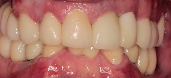 After image