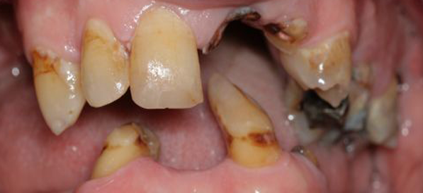 Before image