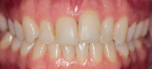 Before image
