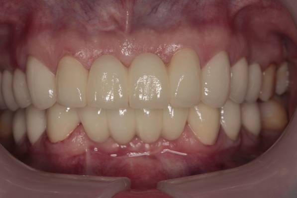 After image