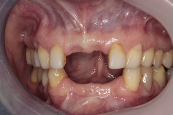 Before image
