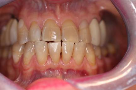 Before image